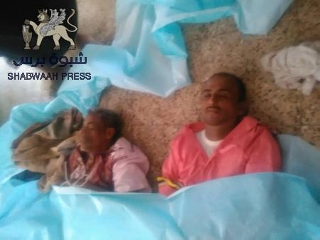 قاعدة صنعاء الإرهابية في أبين تحصد أرواح 20 جنديا وعشرات الجرحى