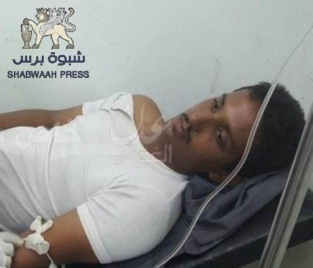 اصابة الاعلامي محمد عبدالحكيم بالرصاص الراجع بساحة العروض .