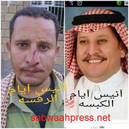 حزب الاصلاح وعلي محسن يسرقون ‘‘مسمى الحراك الجنوبي‘‘