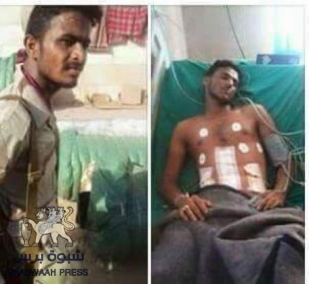 ‘‘محمد باوزير‘‘ و‘‘خالد هادي‘‘ يجسدان وحدة الدم الجنوبي عمليا