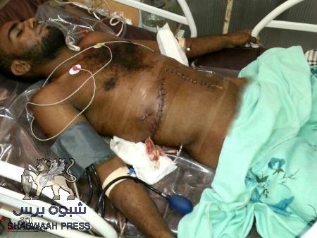 ‘‘الفساد في حضرموت‘‘ مدير صحة الساحل يطلب من أقارب جريح إستئجار باص لنقله الى مسقط (وثائق وصور)