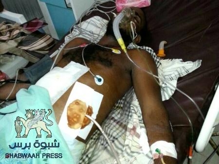 مدير صحة حضرموت يعقب على خبر الجريح ‘‘بازياد‘‘ المنشور في ‘‘شبوه برس‘‘