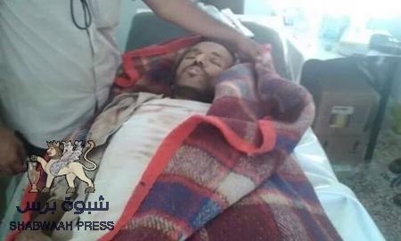 تقرير مفصل عن معارك الشريف لتحرير بيحان اليوم الاحد 29 مايو 2016م