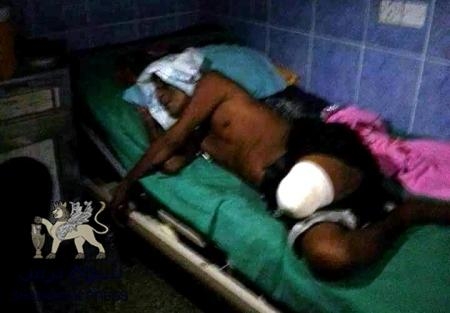 المرضى والجرحى يعيشون في الظلام : مستشفيات في عدن تغلق ابوابها (صور مؤلمة)