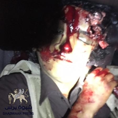 عاجل : طائرة بدون طيار تقتل ثلاثة أشخاص في شبوه ونجاة الرابع