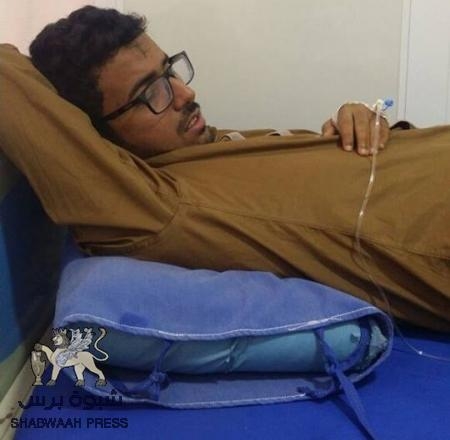 نداء استغاثة عاجل للمنظمات الدولية بعد انتشار حمى الضنك في ميفعة ومستشفى عزان العام يفتقر لجهاز عزل الصفائح الدموية .