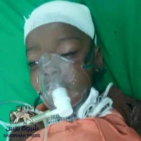 طفلة المكلا ‘‘منار‘‘: قتلها رصاص الأعراس الراجع
