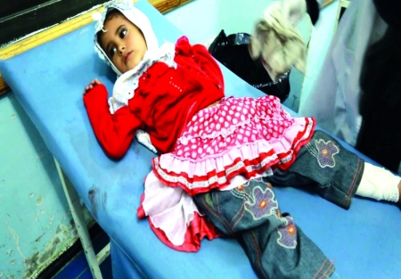 فعاليات يمنية تثمّن مبادرة الإمارات في علاج جرحى الحرب