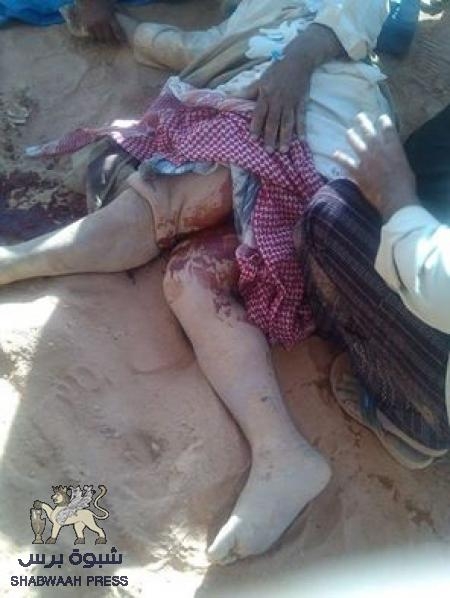 صور من الوديعة تنسف رجولة علي محسن وهاشم الأحمر (صور)