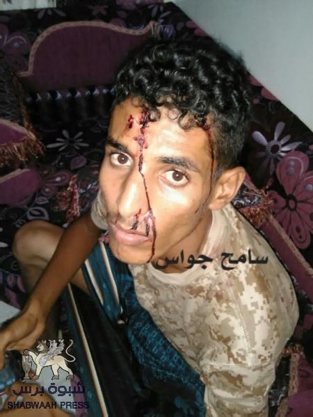 التحالف الدولي: يطالب بالتحقيق باعتقال وضرب نجل السجين ‘‘المرقشي‘‘ من قبل الحزام الأمني بعدن