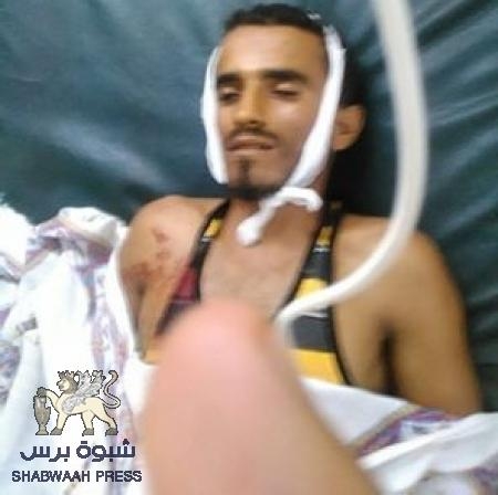 مقتل جندي من الحزام الامني بلحج برصاص مجهولين