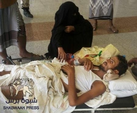 حذر من ثورة غضب للجرحى : جريح جنوبي: المسؤولون همشونا واحتقرونا