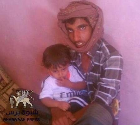 17 شهيد من المقاومة ومثلهم من الجرحى في معارك مع ميليشيا العدوان اليمني ببيحان(أسماء)