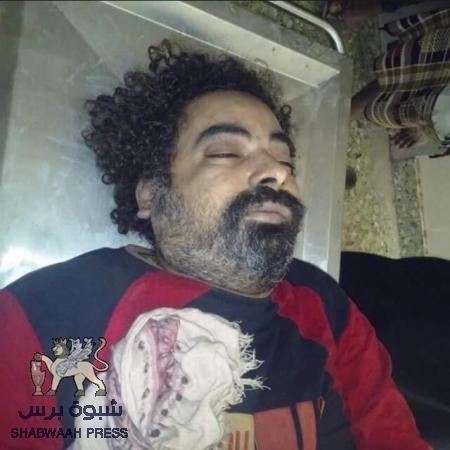 تقرير الطبيب الشرعي يكشف عن أسباب وفاة الشاب حلمي