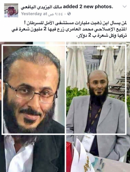 ‘‘شيخ إخواني يمني‘‘ يلحس أموال التبرعات لمرضى السرطان ليزرع بها شعر رأسه