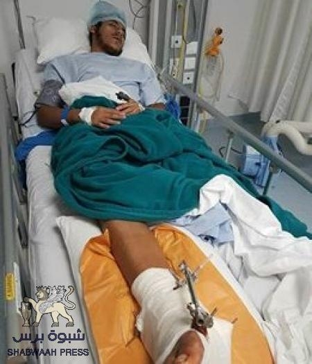 جرحى المقاومة في الهند بين السفر وإجراء العمليات الجراحية بشكل مستمر