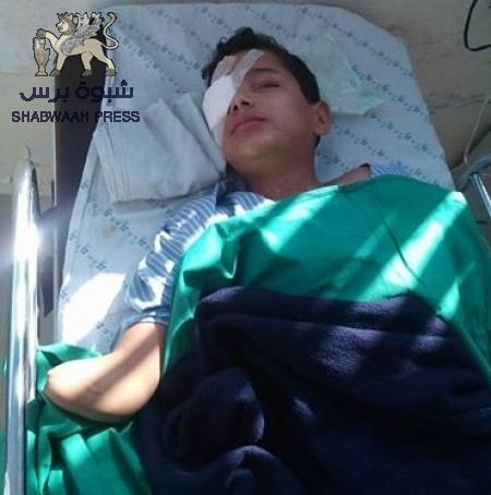 الطفل ‘‘أحمد عبدالله‘‘ أستشهد أخاه وأصيبت أخته وبترت يدهُ وفقد البصر(صور)