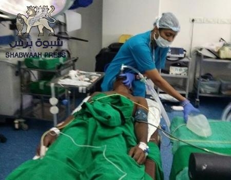 نجاح عملية أزالة رصاصة قناص حوثي سكنت رأس المقاوم أياد ‘‘الكحلي‘‘ في الهند