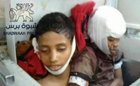 تحولت إلى ساحة للجرائم : طفلان آخر ضحايا الانفلات الأمني بتعز