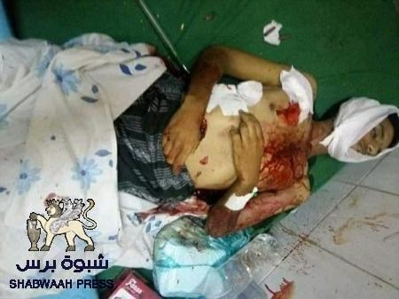اغتيال جنديين في تعز واتهامات لعناصر بـ ‘‘القاعدة‘‘ تابعة للأمن القومي