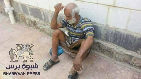 مسلحون من حزب الاصلاح بتعز يعذبون مواطن حتى أفقدوه عقله (صور)