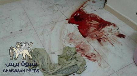 أمين اليافعي : أوقفوا هذا العبث قبل فوات الأوان!