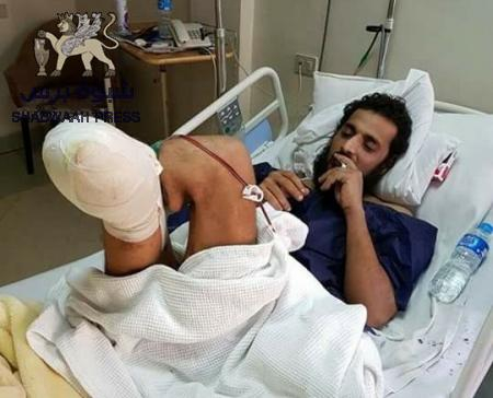 افتتاح الجمعية الخاصة بجرحى الحرب بعدن