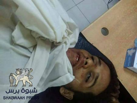 رابطة الجنوب العربي : يتهم مراكز النفوذ في صنعاء بالوقوف خلف العملية الإرهابية في عدن