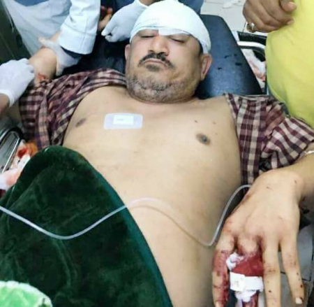 هجوم على منزل القيادي في مقاومة عدن أديب العيسي ومقتل أحد أقاربه