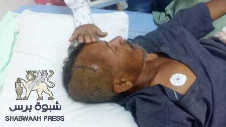 هؤلاء الجرحى أولى بالأموال يا بن دغر ... وليس لصوص المؤتمر