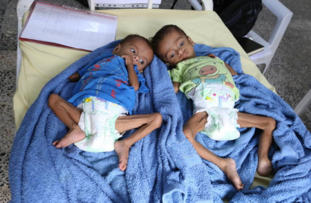 الصحة العالمية تعلن ارتفاع حالات الاصابة بوباء الكوليرا في اليمن الى نحو مليون حالة