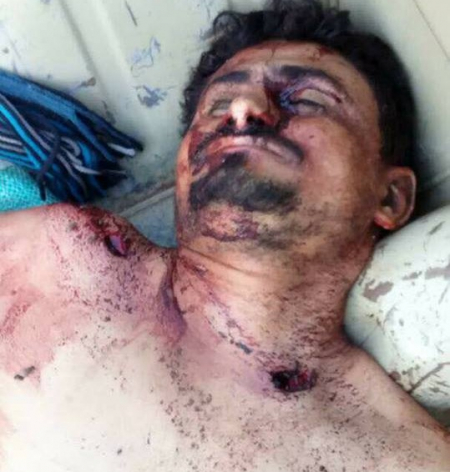 مصرع ‘‘أبو جبريل‘‘ في جبهة الخوخة والمليشيات تتحفظ على نشر خبر مقتله