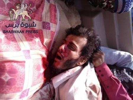 مصـرع قياديان من تنظيم القاعدة بعملية مداهمة في ابين (صور)