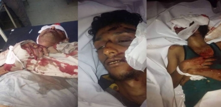 تعز .. حزب الاصلاح يقود حرب تطهير طائفية ضد السلفيين