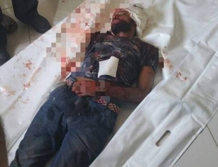 استشهاد متظاهر برصاص قناصة حزب الاصلاح بمدينة قعطبة اليمنية