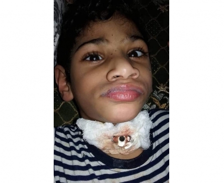 مواطن من عدن يناشد أهل الخير انقاذ طفله