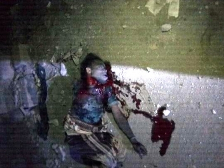 مقتل شخص بقنبلة يدوية كان يحملها لإلحاق أذى بشخص آخر