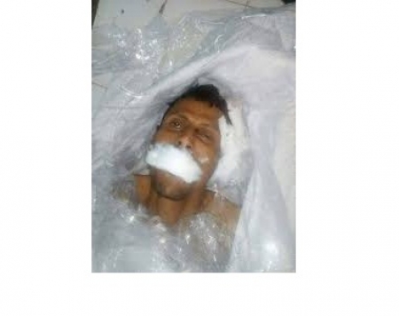 مقتل نازح من الحـديدة في مأرب هرب من رصاص الحرب وسلطات المحافظة لم تحرك ساكنا