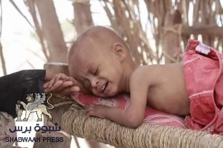 هل من انسانية هل من منقذ .. مديرية الازارق بالضالع دخلت دائرة الخطر بسبب المجاعة (مناشدة)