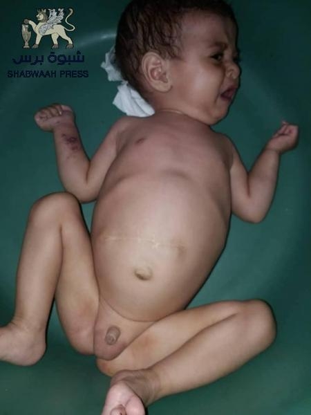 الأزارق تصرخ أضاعوني أضاعوني حتى غزت الأمراض جسدي (صور)