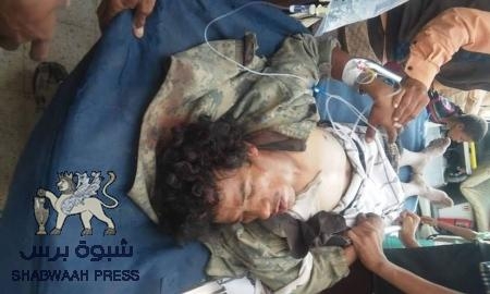 انفجار عبوة ناسفة في محفد أبين يسفر عن استشهاد جنديين